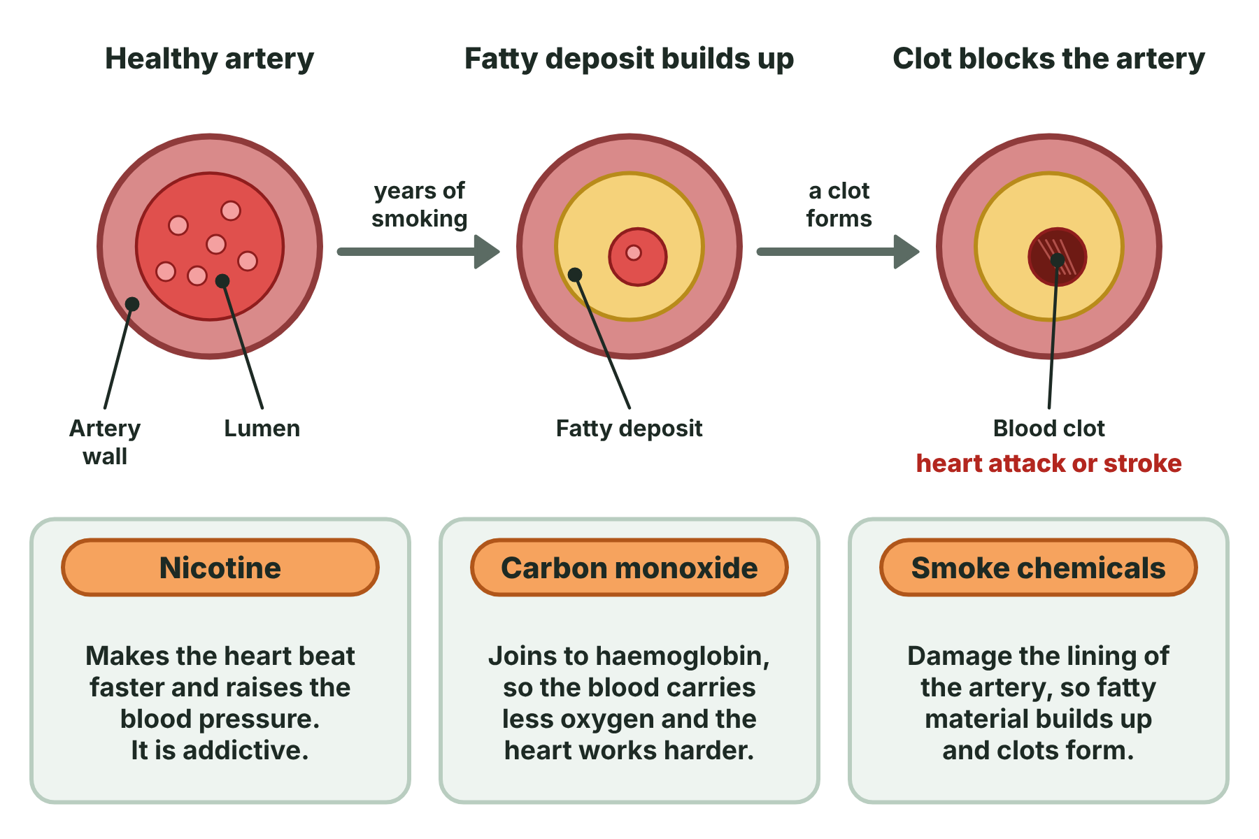 Three cross-sections of an artery that is healthy, narrowed by a fatty deposit, and blocked by a clot, with the effects of nicotine, carbon monoxide and other chemicals in smoke.