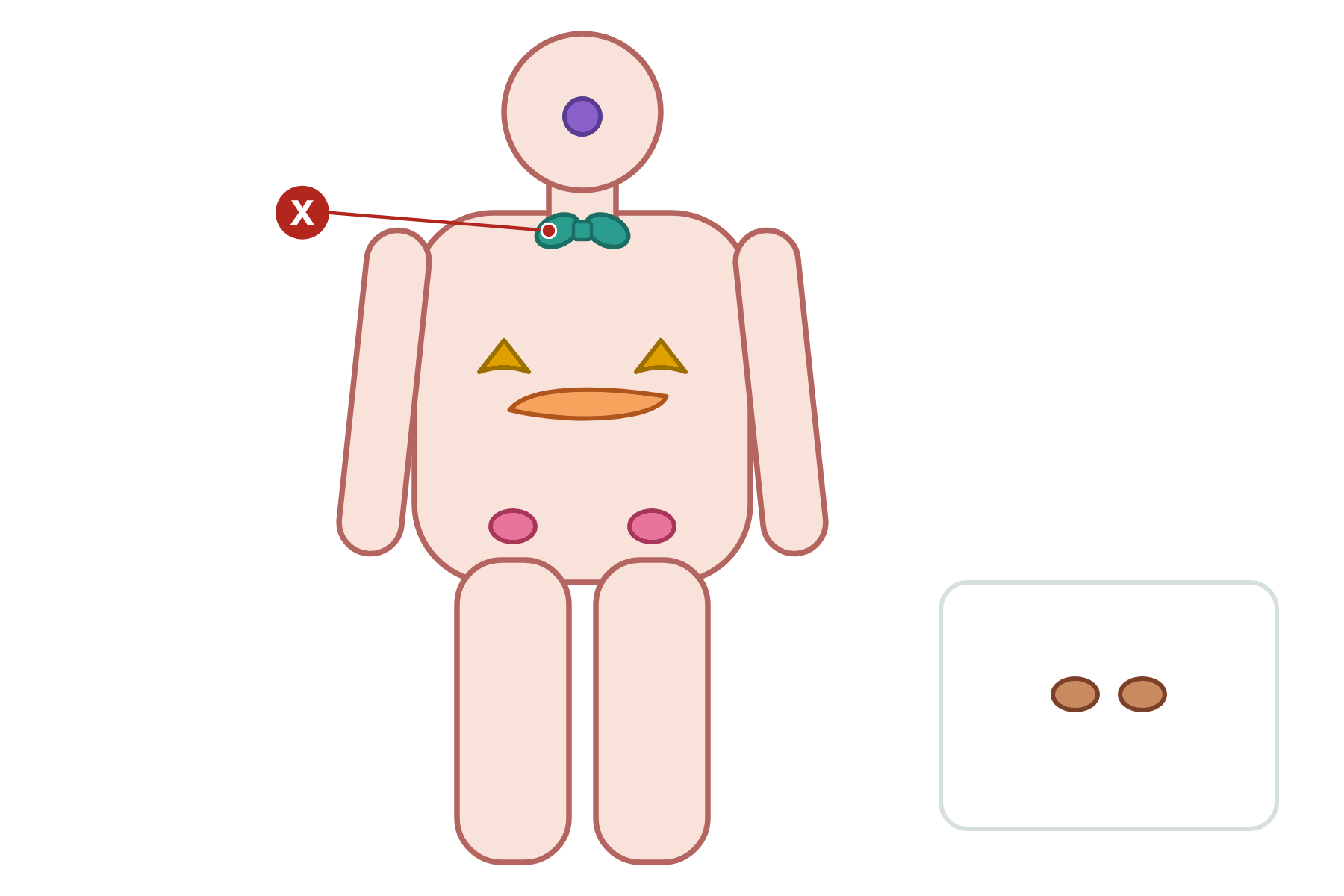 A body with the endocrine glands and a pointer marked X to the thyroid gland.