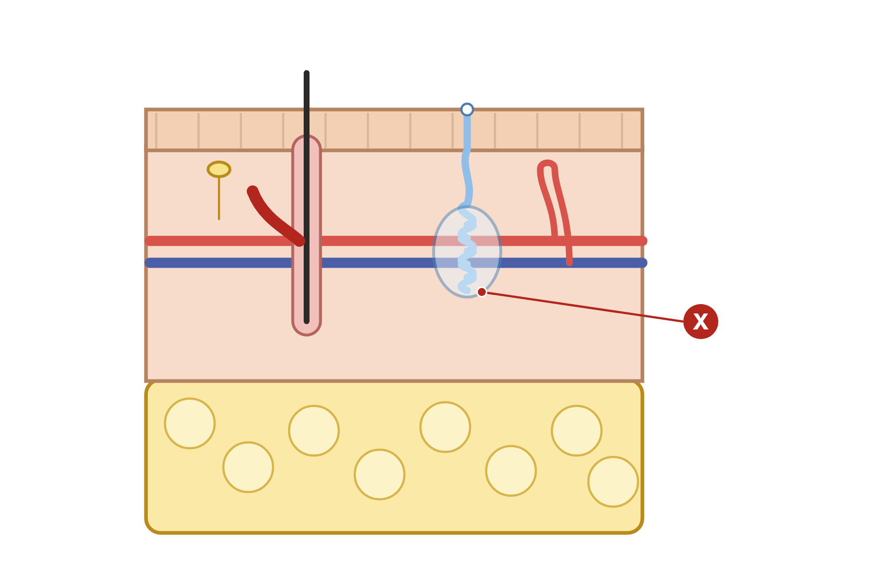 A skin section with a pointer marked X to the sweat gland.