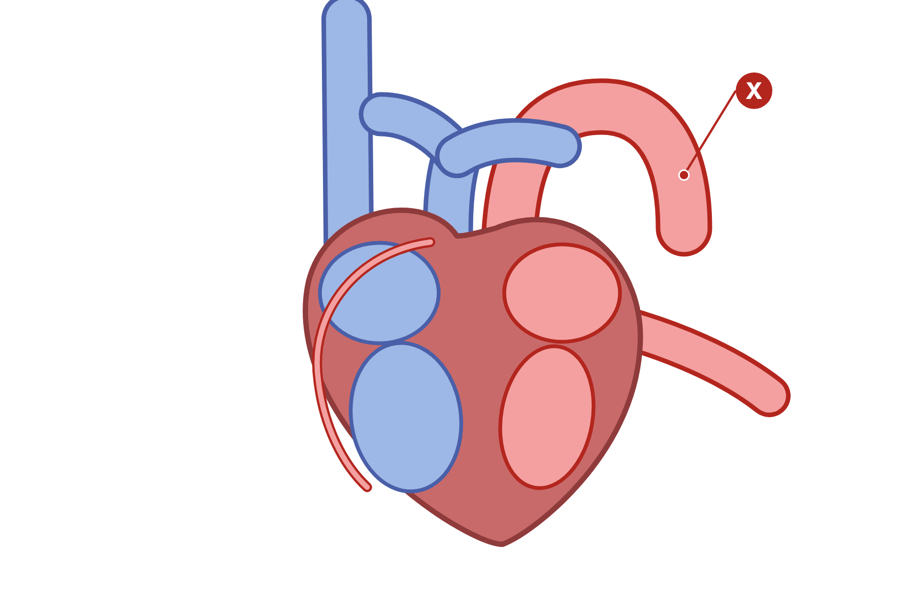 A heart with a pointer marked X to the aorta.