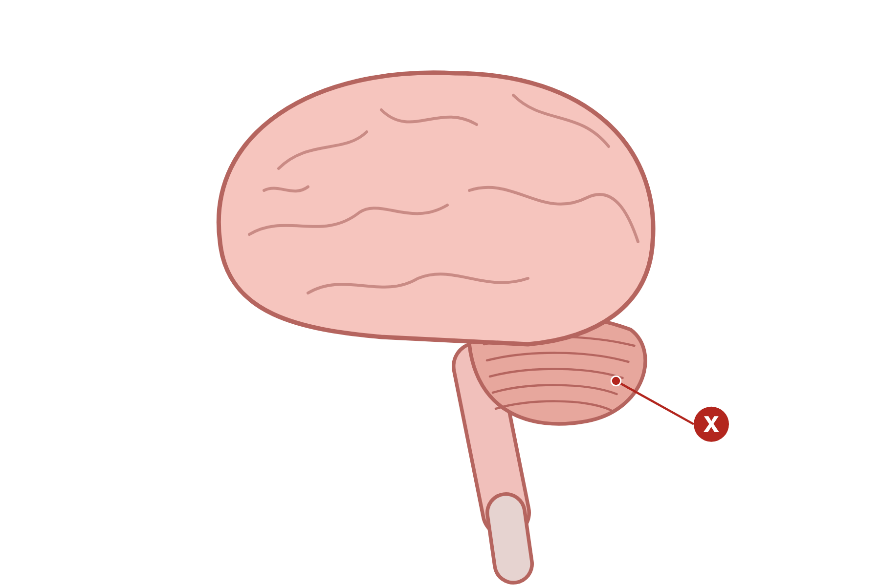 A brain with a pointer marked X to the cerebellum.