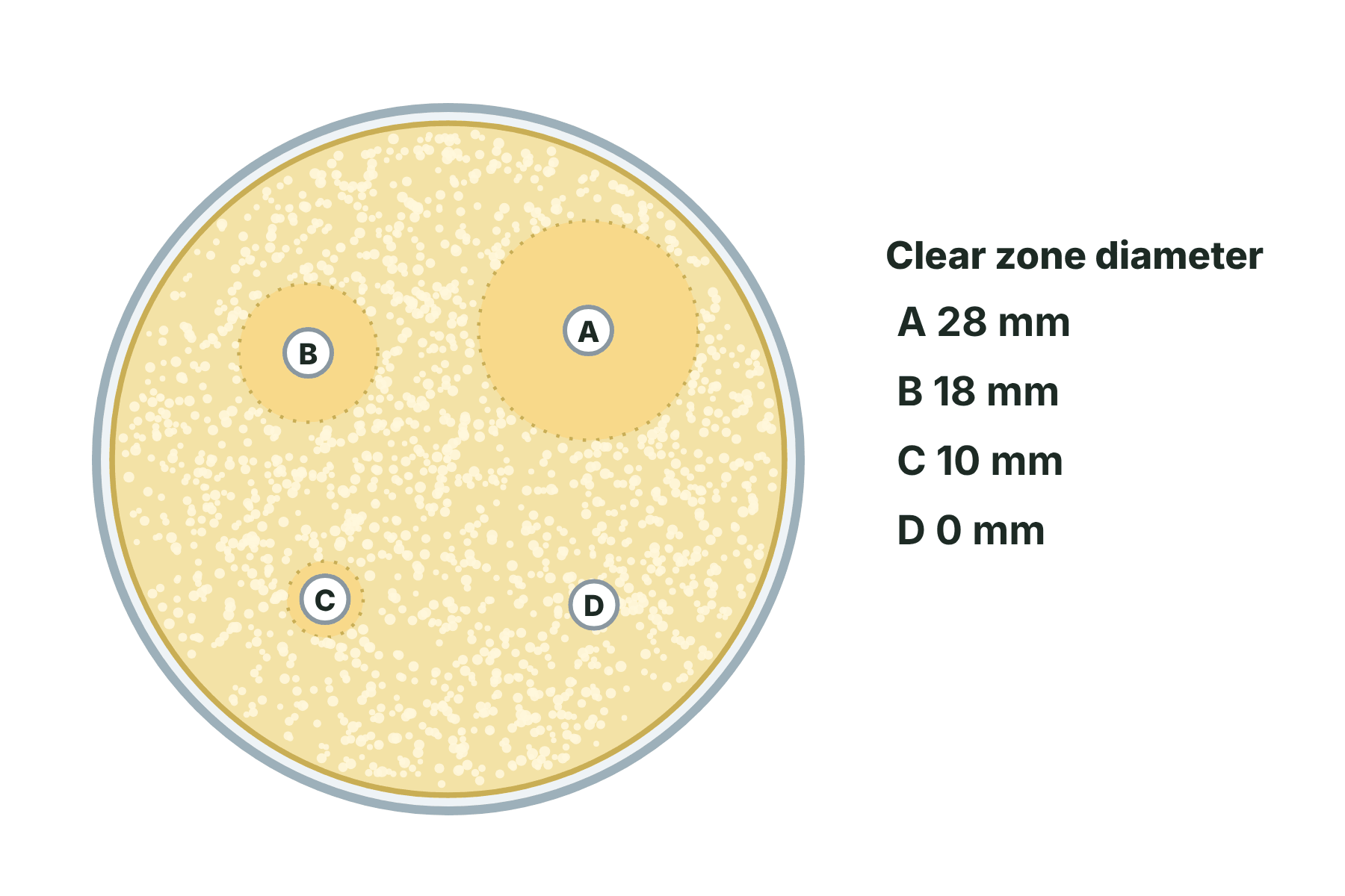 A Petri dish with four discs and a key giving the clear zone diameters as 28 mm, 18 mm, 10 mm and 0 mm.