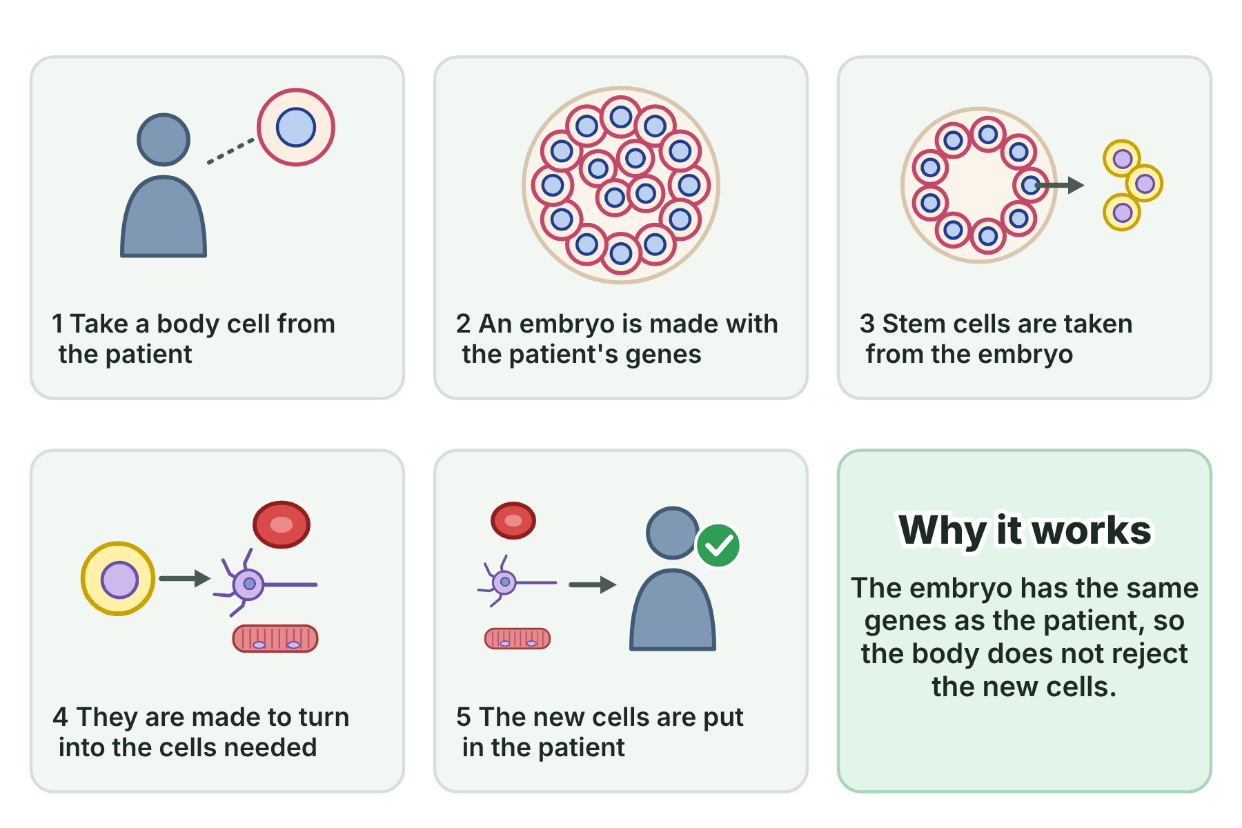 Five steps of therapeutic cloning from taking a cell from the patient to putting new cells in the patient, with a panel explaining why the cells are not rejected.