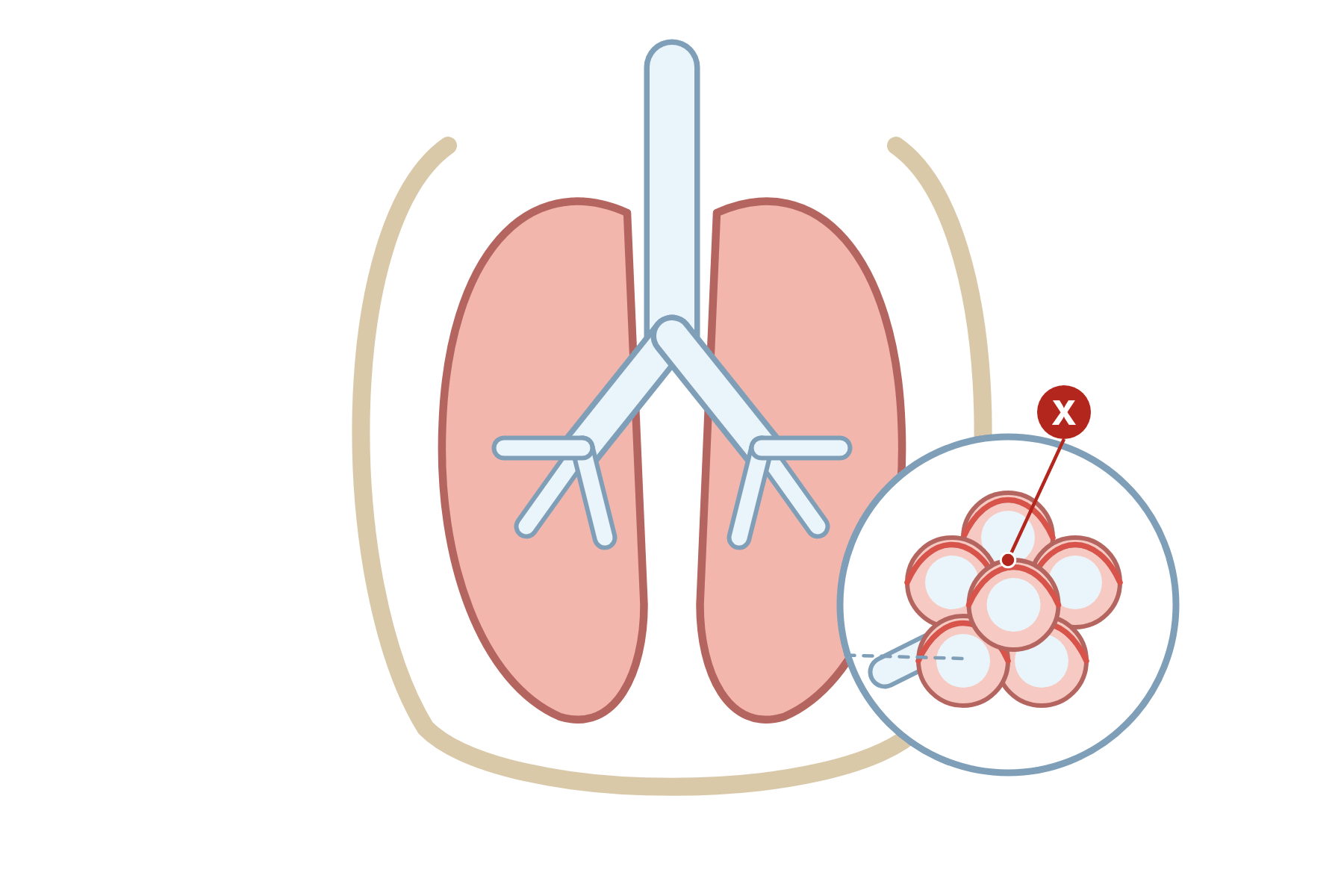 The lungs with a pointer marked X to the alveoli.