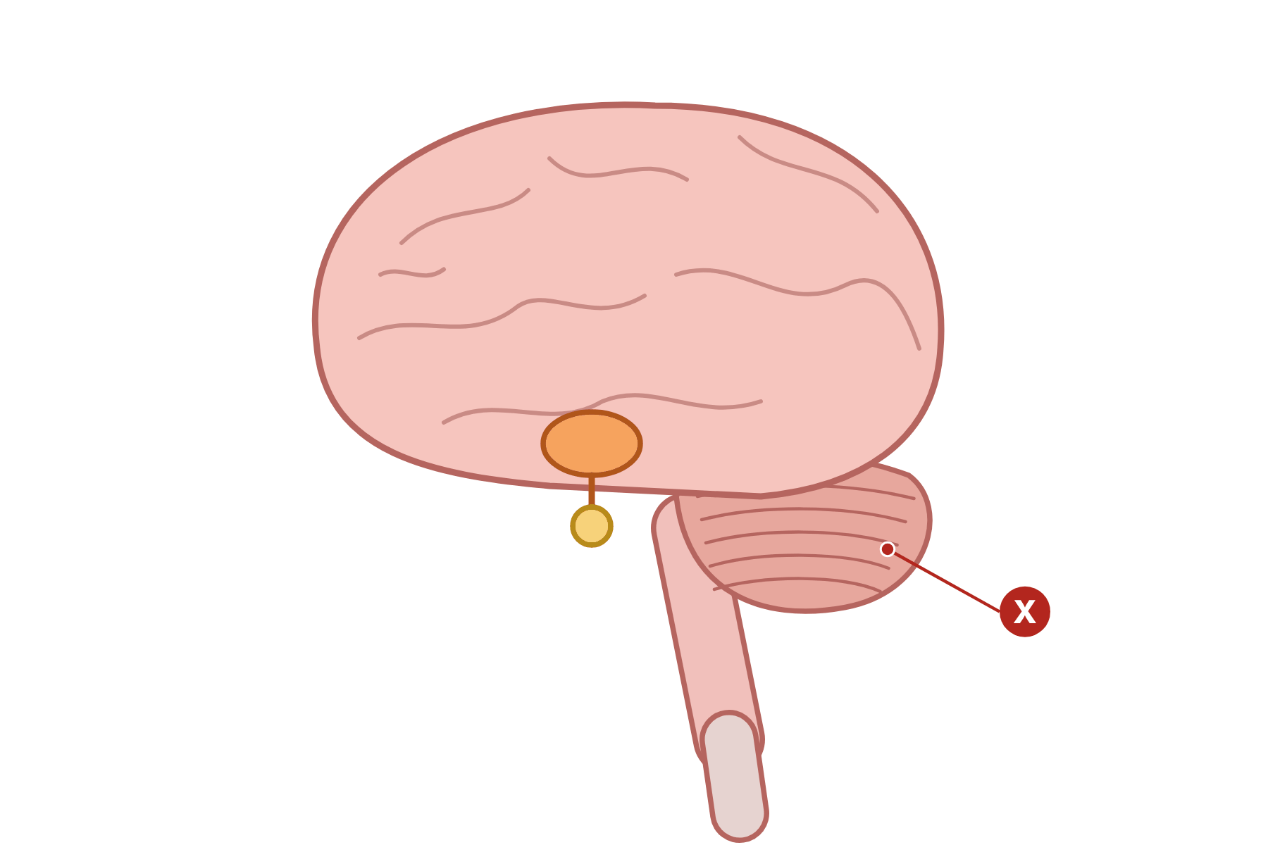 A brain with a pointer marked X to the cerebellum.