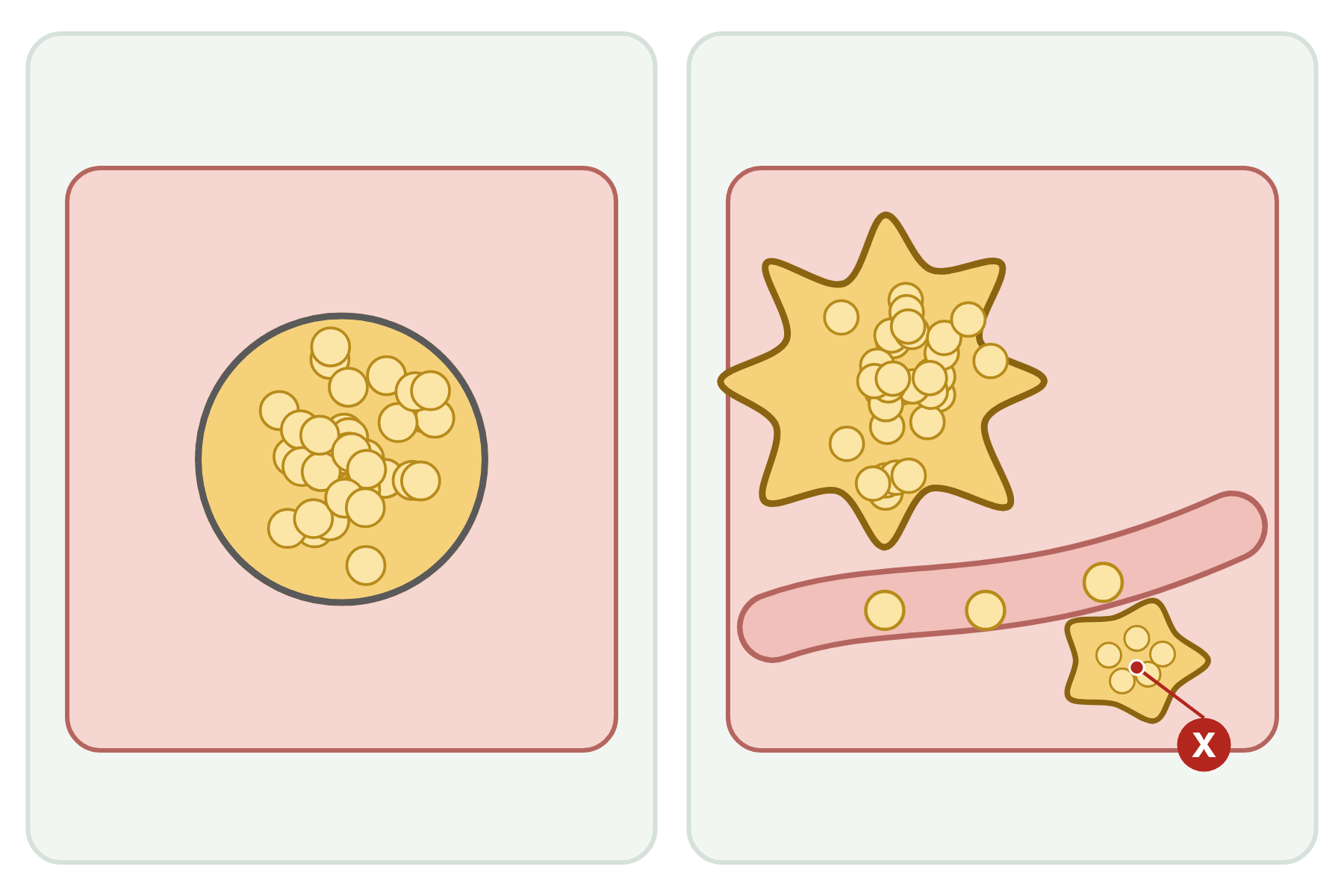 A benign and a malignant tumour with a pointer marked X to the secondary tumour.
